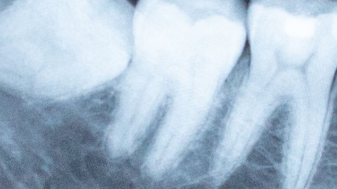 are dental x-rays necessary -